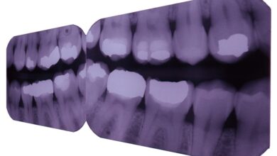 Photo of Рентген зубов и челюсти