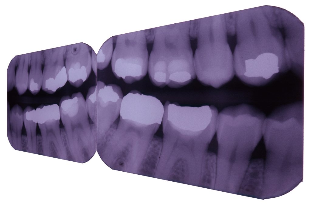 Фото 5 — Рентген зубов и челюсти