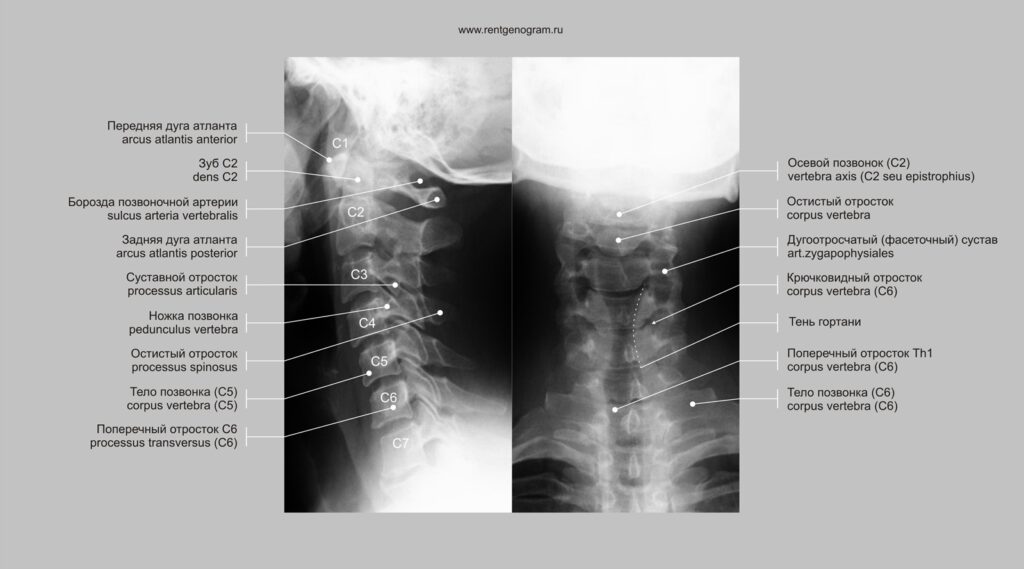 Фото 36 — Рентген позвоночника в профиле