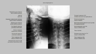 Photo of Рентген позвоночника в профиле