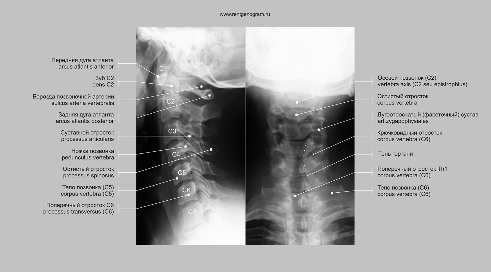 Фото 36 — Рентген позвоночника в профиле