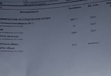 Photo of Анализ мочи на уровень креатинина