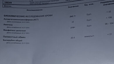 Photo of Анализ мочи на уровень креатинина