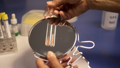 Photo of Анализ мочи на уровень эритроцитов