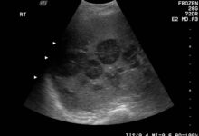 Photo of УЗИ печени с допплерографией