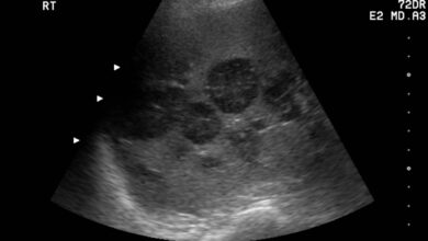 Photo of УЗИ печени с допплерографией