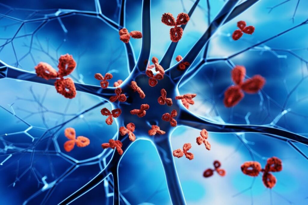 Фото 30 — Лечение аутоиммунных заболеваний