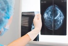 Photo of Маммография для диагностики опухолей