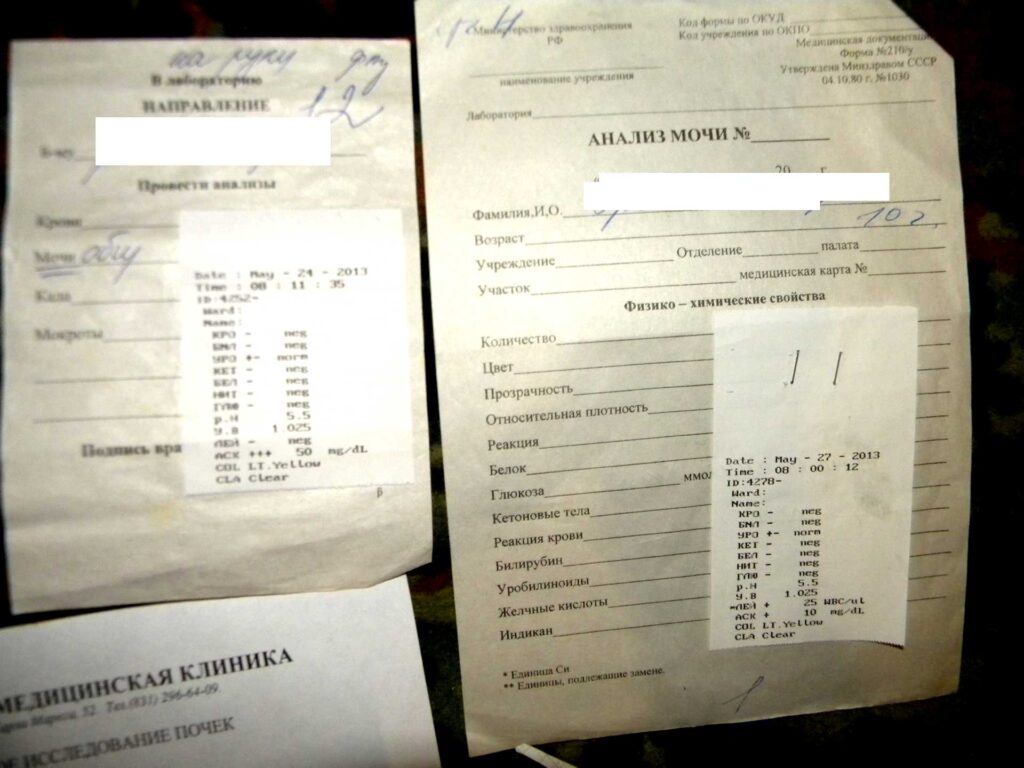 Фото 59 — Анализ мочи на белок