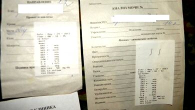 Photo of Анализ мочи на белок