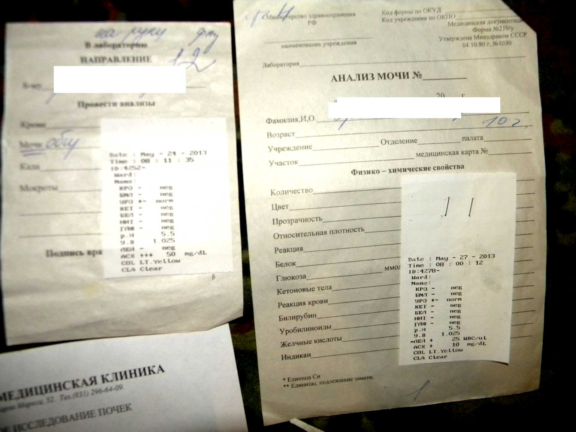 Фото 59 — Анализ мочи на белок