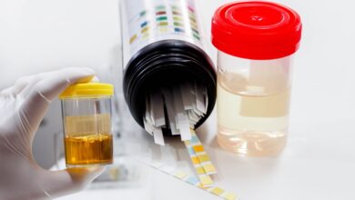 Photo of Анализ мочи на наличие бактерий