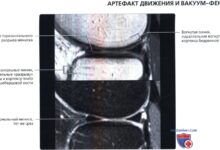 Photo of МРТ коленного сустава без контраста