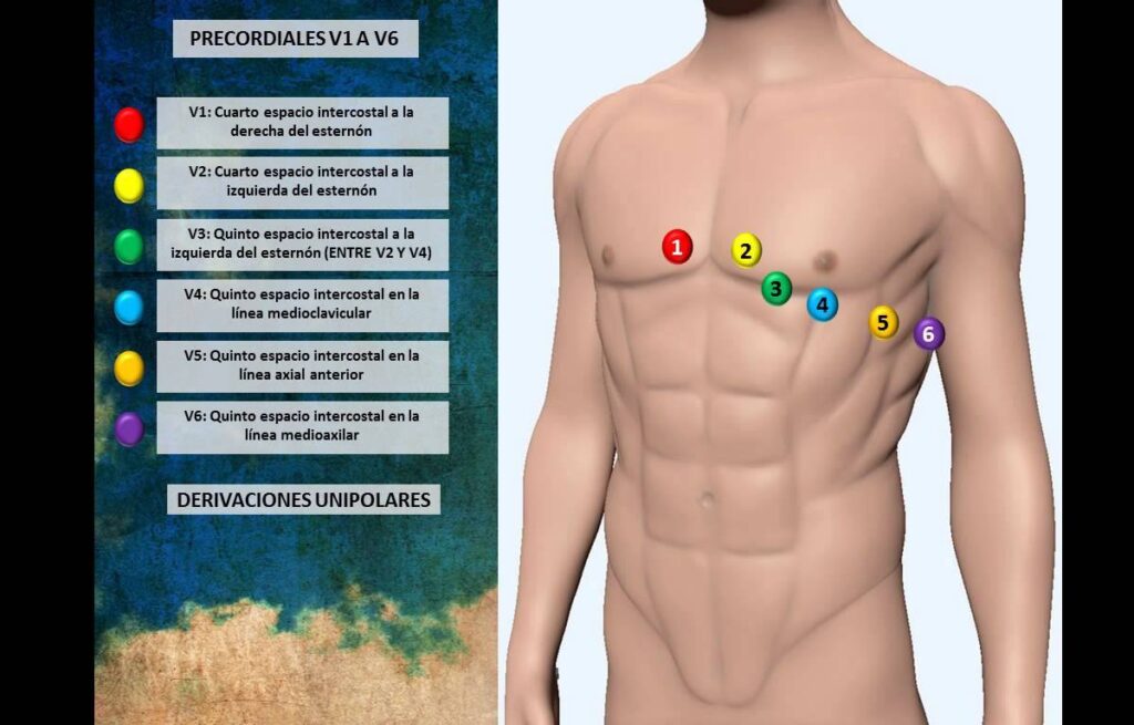 Фото 57 — ЭКГ с нагрузочным тестом