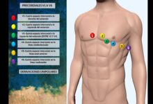 Photo of ЭКГ с нагрузочным тестом