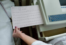 Photo of ЭКГ для выявления аритмии