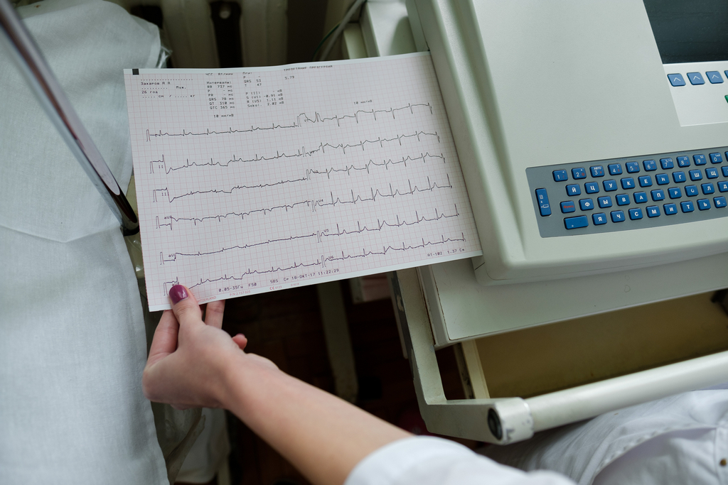 Фото 40 — ЭКГ для выявления аритмии