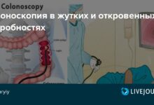 Photo of Кольоноскопия для обследования кишечника