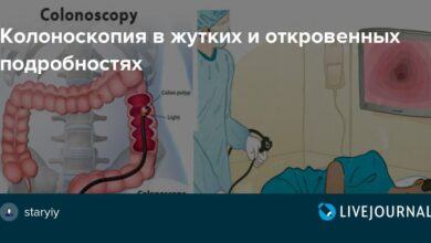 Photo of Кольоноскопия для обследования кишечника