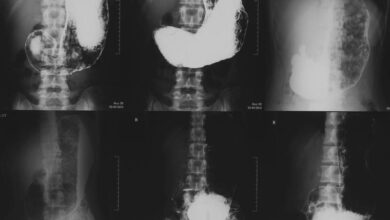 Photo of Гастроэнтероскопия для исследования ЖКТ