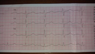 Photo of ЭКГ с записью кардиограммы
