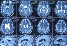 Photo of МРТ головного мозга с ангиографией
