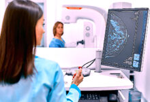 Photo of Маммография для скрининга рака груди