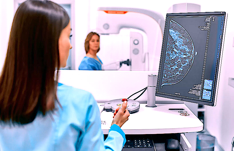 Фото 43 — Маммография для скрининга рака груди