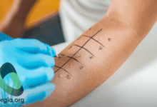 Photo of Диагностика аллергических реакций