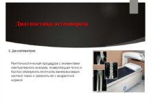 Photo of Диагностика остеопороза у пожилых