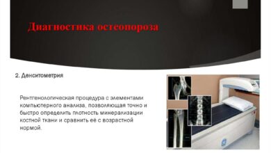 Photo of Диагностика остеопороза у пожилых