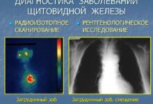 Photo of Диагностика заболеваний щитовидной железы