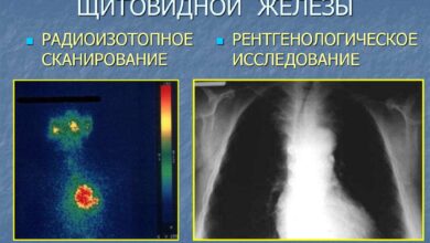 Photo of Диагностика заболеваний щитовидной железы