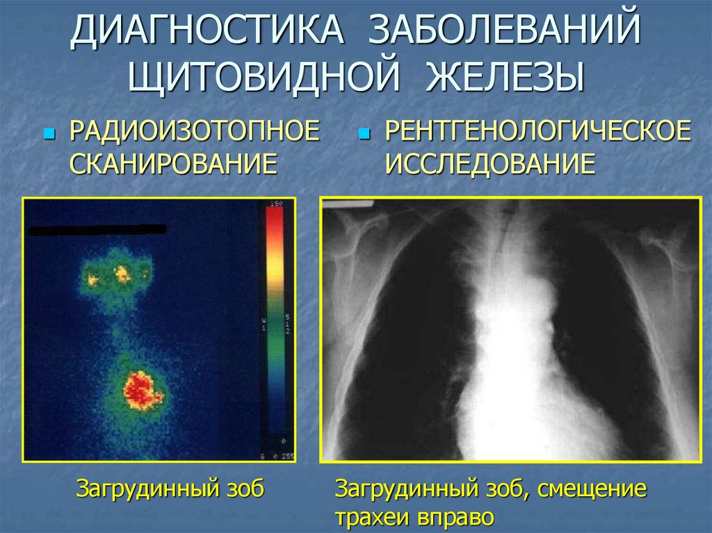 Фото 7 — Диагностика заболеваний щитовидной железы
