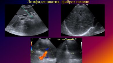 Photo of Диагностика заболеваний печени