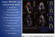 Photo of Эхокардиография с допплером