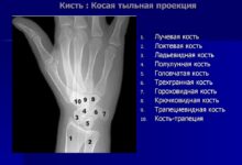 Photo of Рентген суставов для выявления артрита