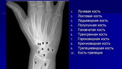 Photo of Рентген суставов для выявления артрита