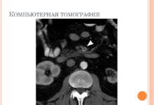 Photo of Диагностика тромбоза кровеносных сосудов