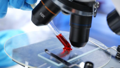 Photo of Анализ крови на наличие вирусов